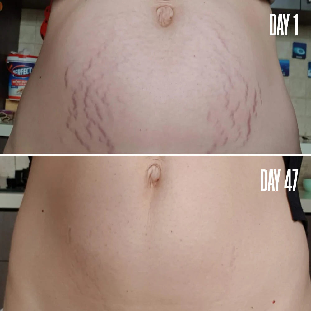VithaFirm™ Body Hydrating Moisturizer Firming