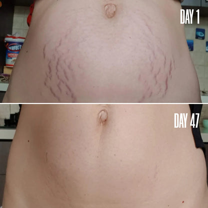 VithaFirm™ Body Hydrating Moisturizer Firming